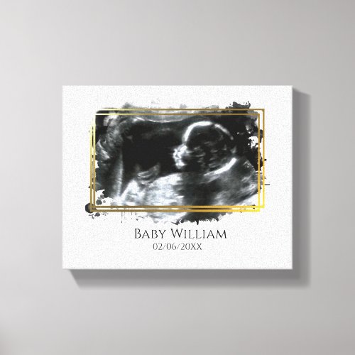 Baby Ultrasound Sonogram Picture Expecting  Canvas Print