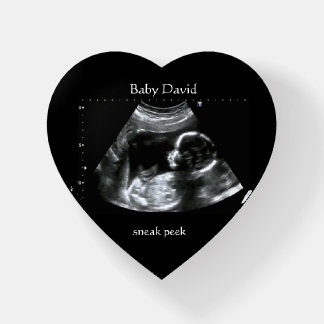 Baby Ultrasound Sonogram Picture Gift Paperweight