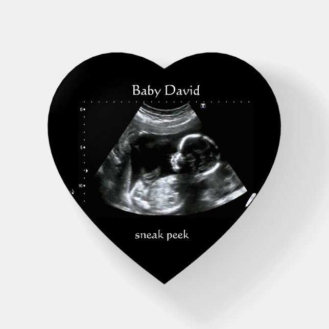 Baby Ultrasound Sonogram Picture Gift Paperweight (Front)