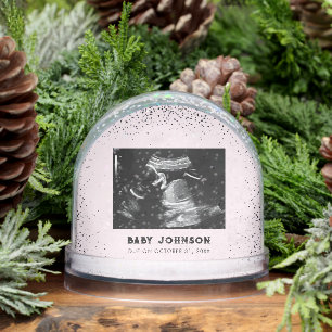 Baby Ultrasound   Sonogram Pregnancy Announcement Snow Globe