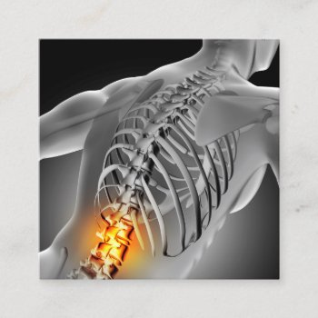 Back Pain Photo Graphic Square Chiropractic Square Business Card by chiropracticbydesign at Zazzle