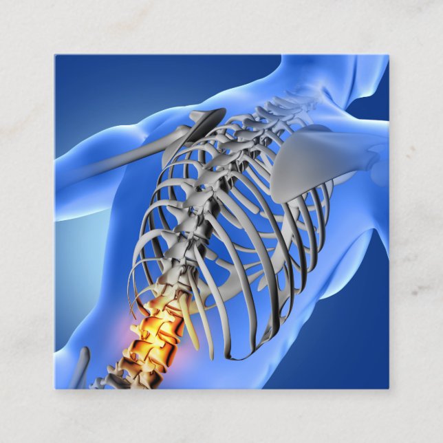 Back Pain Photo Graphic Square Chiropractic Square Business Card (Front)