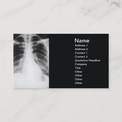 back xray business card