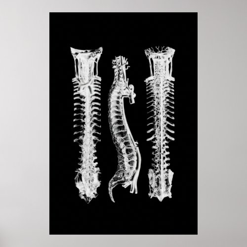 Backbone Anatomy Wall Decor Medical Art Poster