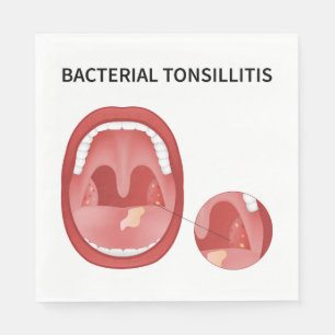 Bacterial tonsillitis napkins