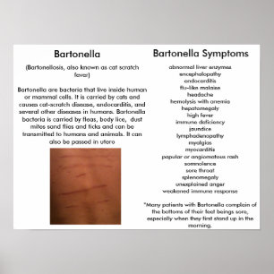 Bartonella Symptoms Educational Poster
