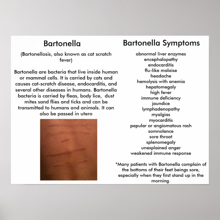 Bartonella Symptoms Educational Poster | Zazzle.com