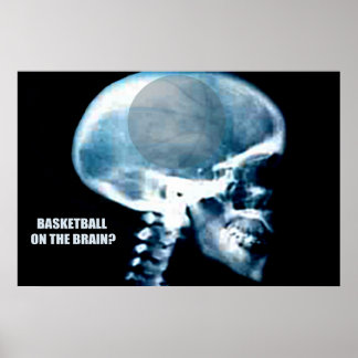 Basketball Head (X-ray) Poster