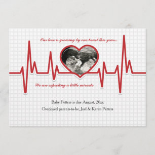 Beating Heart Photo Pregnancy Announcement