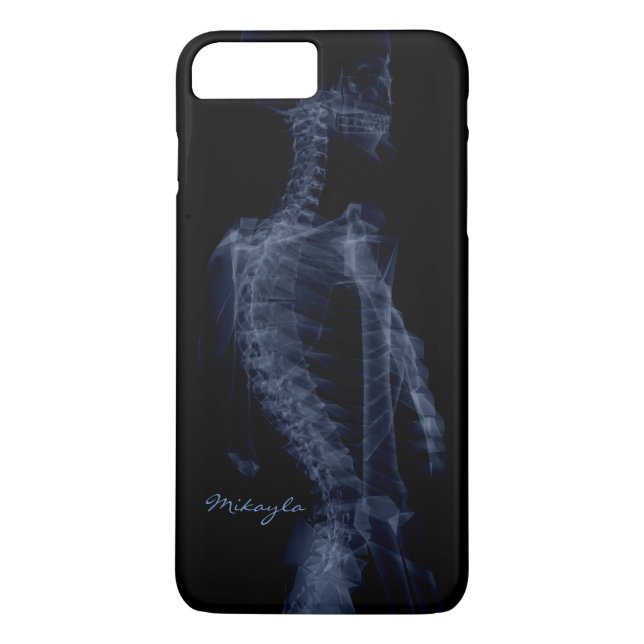 Beautiful, Personalized Body X-Ray Case-Mate iPhone Case (Back)