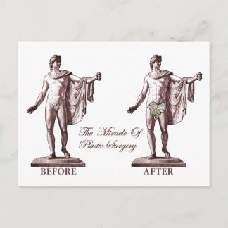 Before and After Postcard
