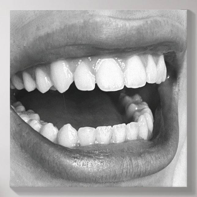 Big Mouth Photo on Canvas Tile (Front Set)