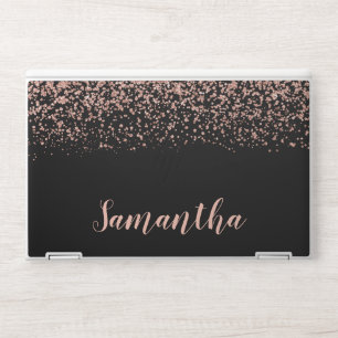 Black Rose Gold Faux Glitter Personalized HP Laptop Skin