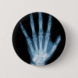 Blue X-ray Skeleton Hand Button