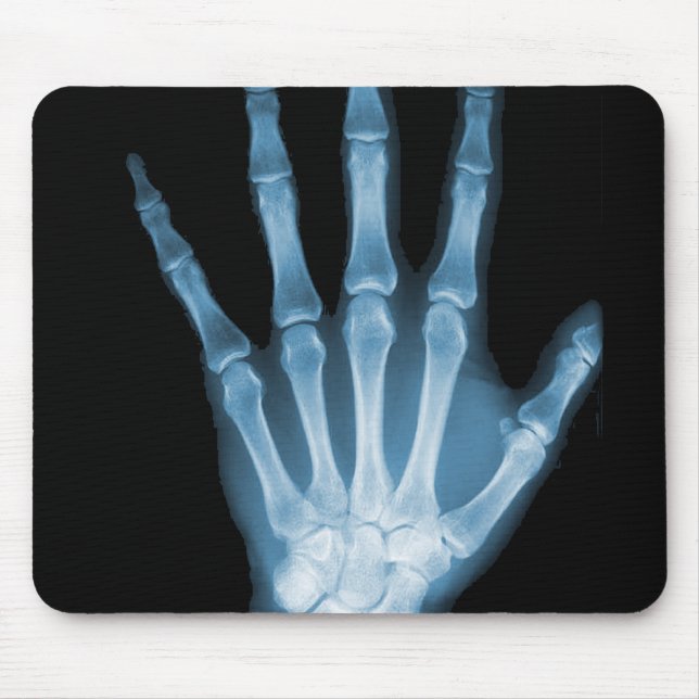 Blue X-ray Skeleton Hand Mouse Pad (Front)