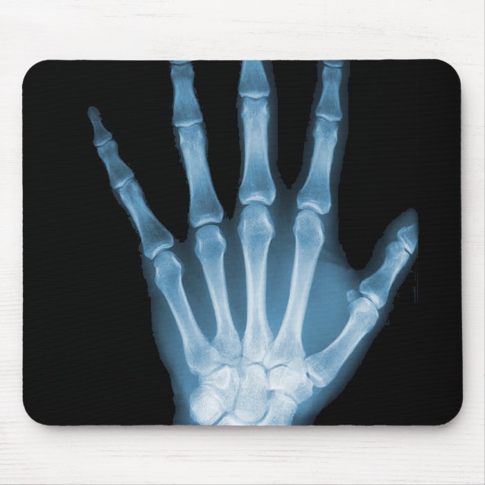 Blue X ray Skeleton Hand Mousepad