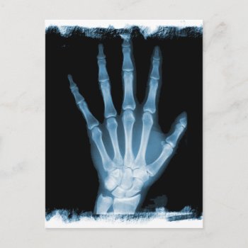 Blue X-ray Skeleton Hand Postcard by VoXeeD at Zazzle