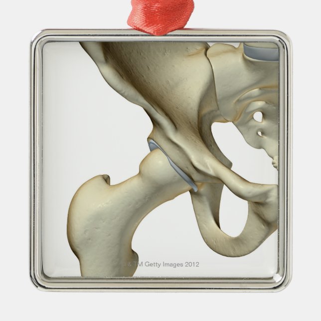 Bones of the Hip 5 Metal Ornament (Front)
