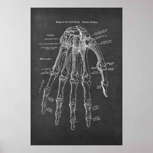 Bones of the Left_Hand Palmar Surface Anatomy Poster