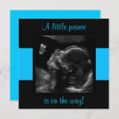 Boy Baby Customized Ultrasound Photo Template (Front/Back)