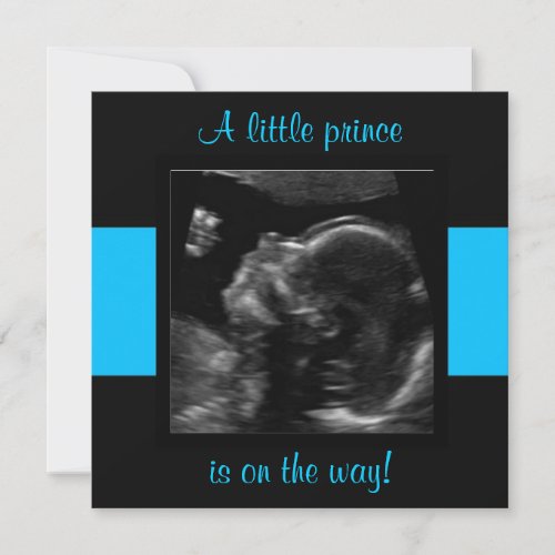 Boy Baby Customized Ultrasound Photo Template Invitation