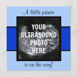 Boy Baby Customized Ultrasound Photo Template