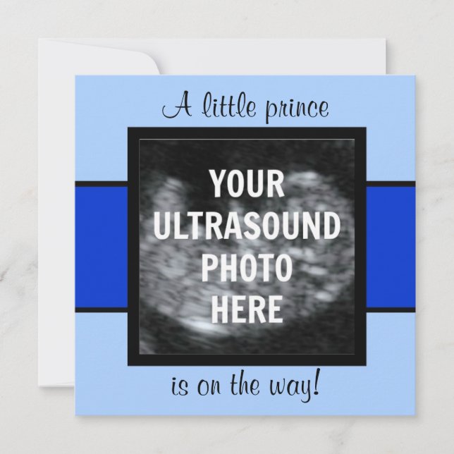Boy Baby Customized Ultrasound Photo Template (Front)