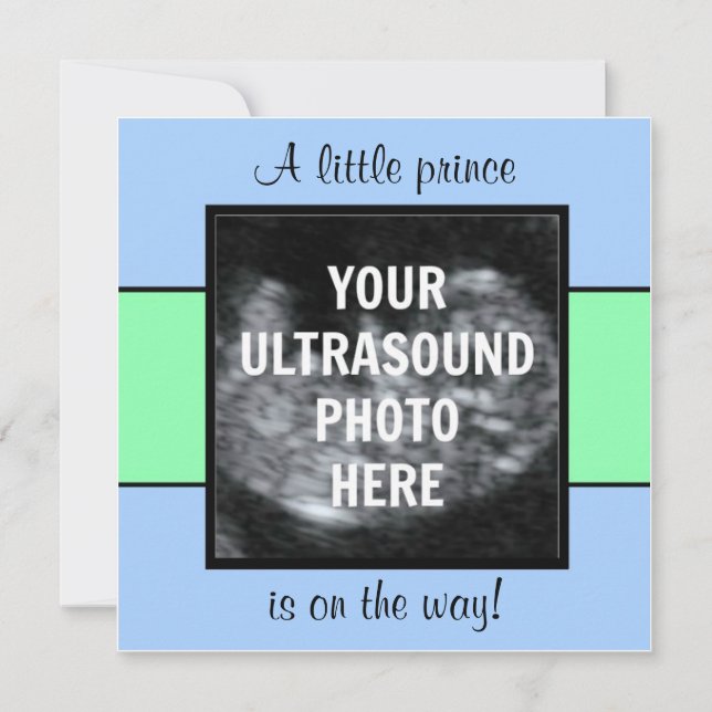 Boy Baby Customized Ultrasound Photo Template (Front)