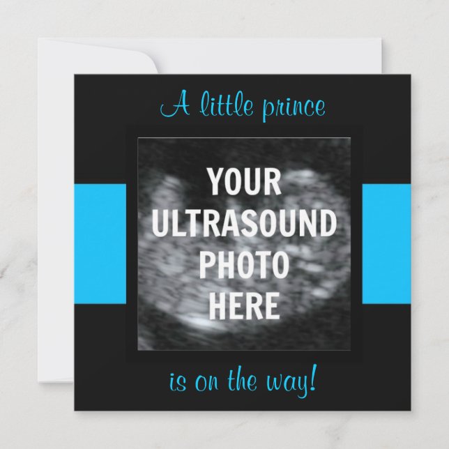 Boy Baby Customized Ultrasound Photo Template (Front)