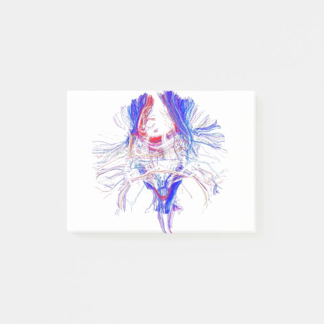 Brain and Tracktography Post-it Notes (Front)