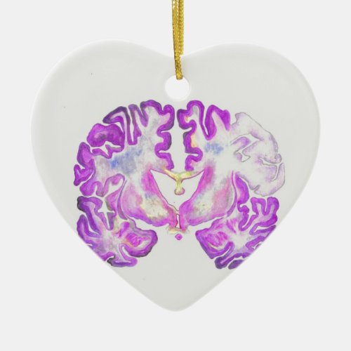 Brain Ceramic Ornament