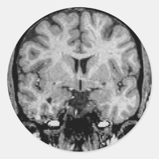 Brain MRI, coronal slice Classic Round Sticker