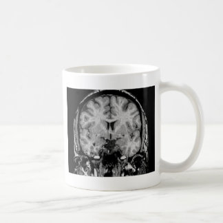 Brain MRI, coronal slice Coffee Mug