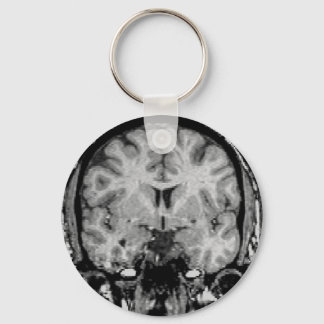 Brain MRI, coronal slice Keychain