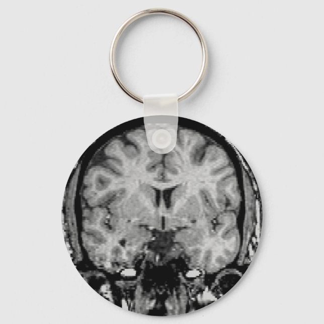 Brain MRI, coronal slice Keychain (Front)