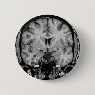 Brain MRI, coronal slice Pinback Button