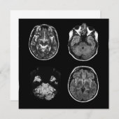 Brain MRI scan (Front/Back)