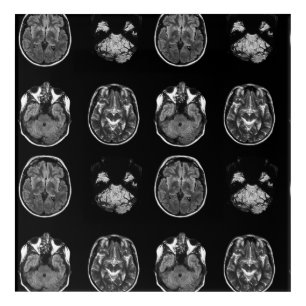 Brain MRI scan Acrylic Print