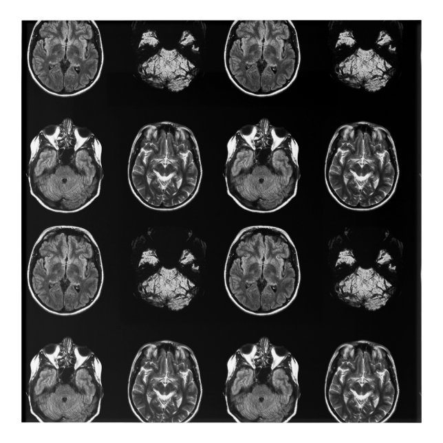 Brain MRI scan Acrylic Print (Front)