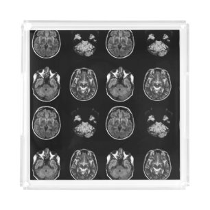 Brain MRI scan Acrylic Tray