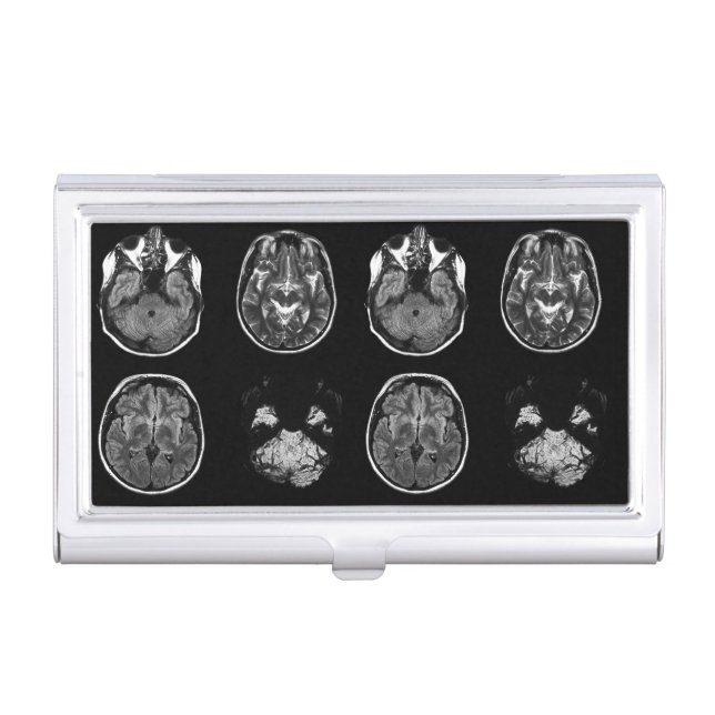 Brain MRI scan Business Card Case (Front)