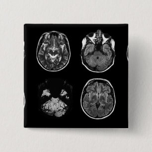 Brain MRI scan Button