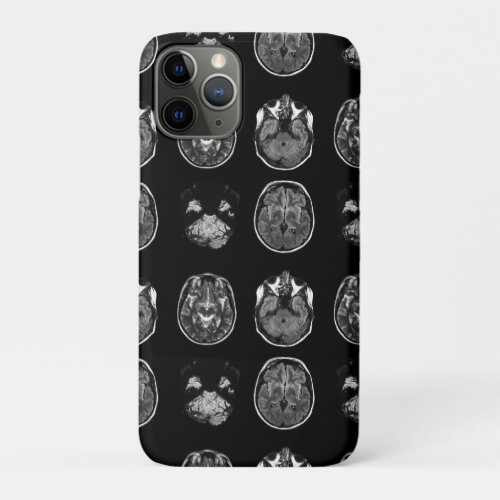 Brain MRI scan iPhone 11 Pro Case