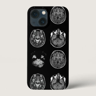 Brain MRI scan iPhone 13 Mini Case