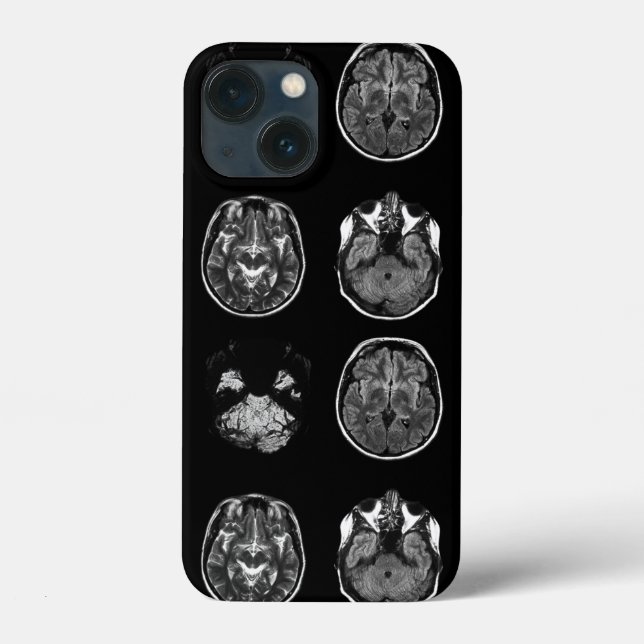 Brain MRI scan Case-Mate iPhone Case (Back)