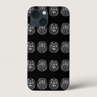 Brain mri scan iPhone 13 mini case
