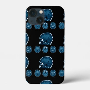 Brain Mri scan iPhone 13 Mini Case