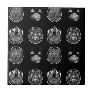 Brain MRI scan Ceramic Tile