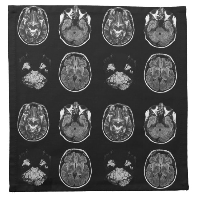 Brain MRI scan Cloth Napkin (Front)