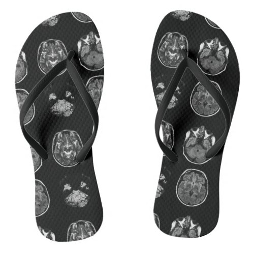 Brain MRI scan Flip Flops